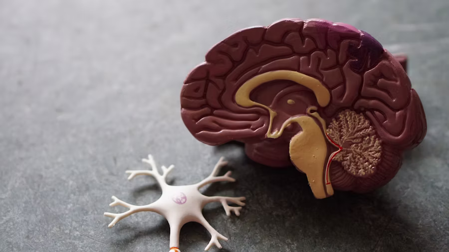 Modelo anatómico del cerebro humano para neurocirugía en Monarka Clinic Barcelona