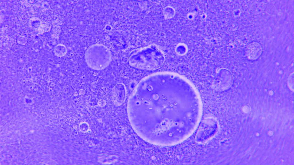 Imagen microscópica de células, representando el proceso de autofagia activado por el ayuno intermitente